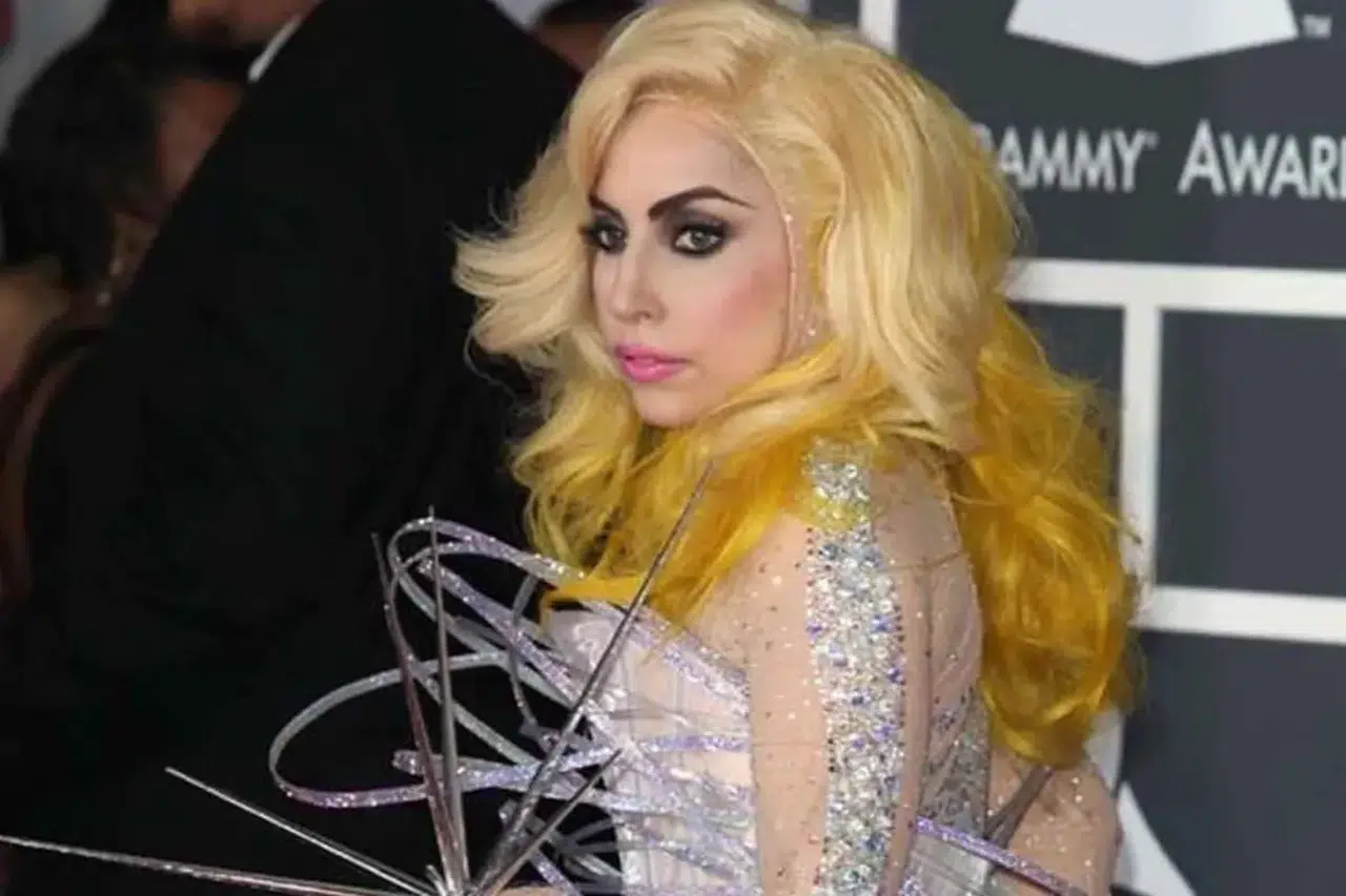 Lady Gaga Gizlediği Sağlık Krizini Açıkladı! “Tamamen Çökmüştüm, Hayatta Olduğum İçin Şanslıyım”