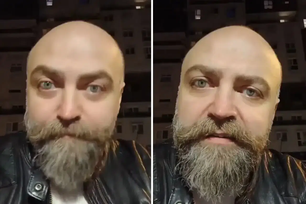 "Kafasız Kazık mı?" 800 TL’lik Traş Faturası Saçları Olmayanları Ayağa Kaldırdı!