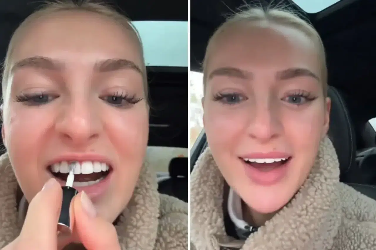 Diş beyazlatmak için oje mi kullanılır? Sosyal medyada tepki çeken video!