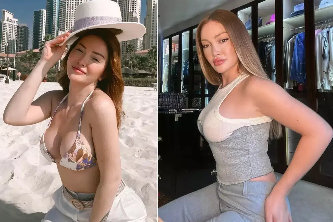 Danla Bilic neden ameliyat oldu? Kalça dolgusu yüzünden yaşadığı sağlık sorunu ne?