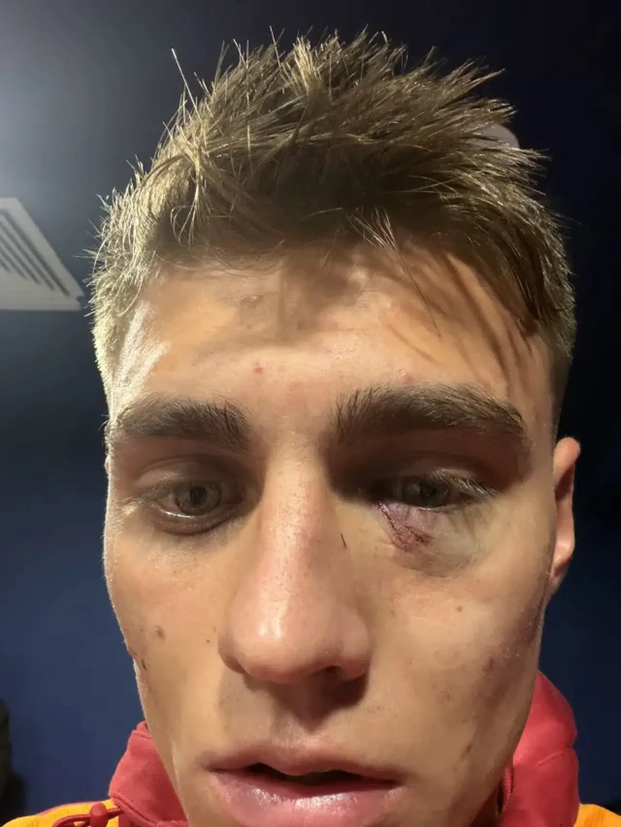 Kazımcan Karataş’a ne oldu? Galatasaray - Fenerbahçe derbisinde yaşanan olayın detayları