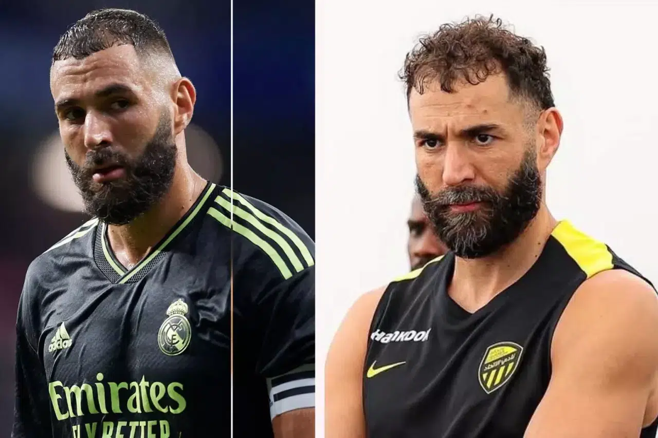 Arabistan’da Benzema’ya Ne Oldu? Yüz Hatları ve Saçındaki Beyazlar Dikkat Çekti