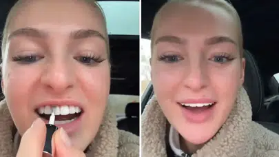 Diş beyazlatmak için oje mi kullanılır? Sosyal medyada tepki çeken video!