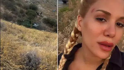 Almeda Baylan Geçirdiği Trafik Kazasıyla Korkuttu: Gözyaşları İçinde Yardım İstedi