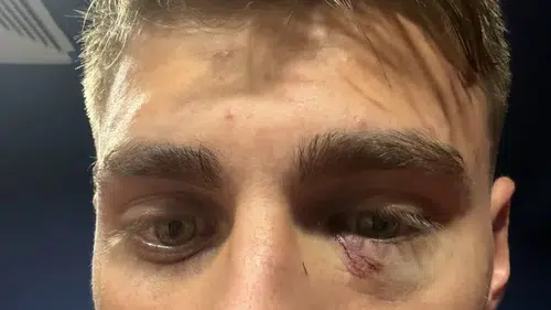 Kazımcan Karataş’a ne oldu? Galatasaray - Fenerbahçe derbisinde yaşanan olayın detayları