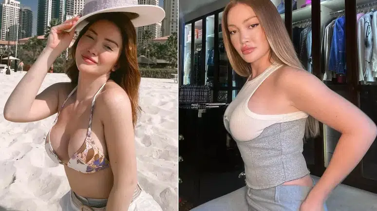 Danla Bilic neden ameliyat oldu? Kalça dolgusu yüzünden yaşadığı sağlık sorunu ne?