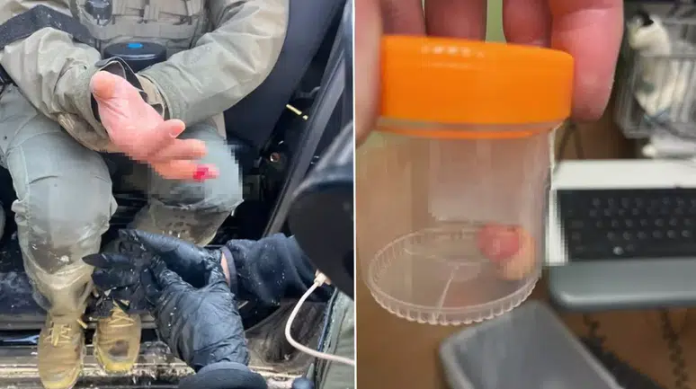 ICE Protestosunda Şok! Tricia McLaughlin, Ajanın Parmağını Kaybettiğini Duyurdu