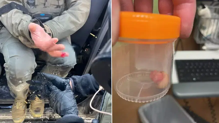 ICE Protestosunda Şok! Tricia McLaughlin, Ajanın Parmağını Kaybettiğini Duyurdu